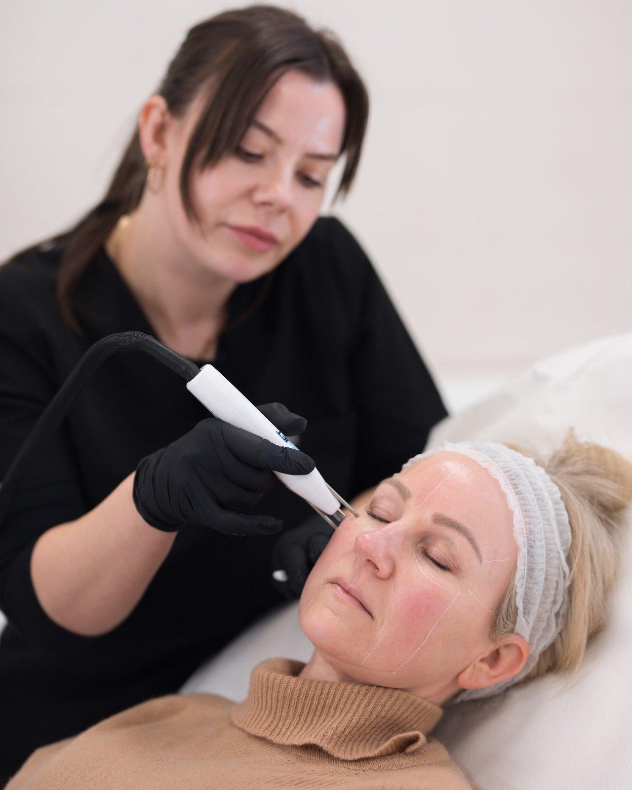 Unveil smoother skin with Morpheus8 treatments